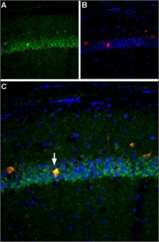 Anti-Sodium Channel PN4 antibody produced in rabbit