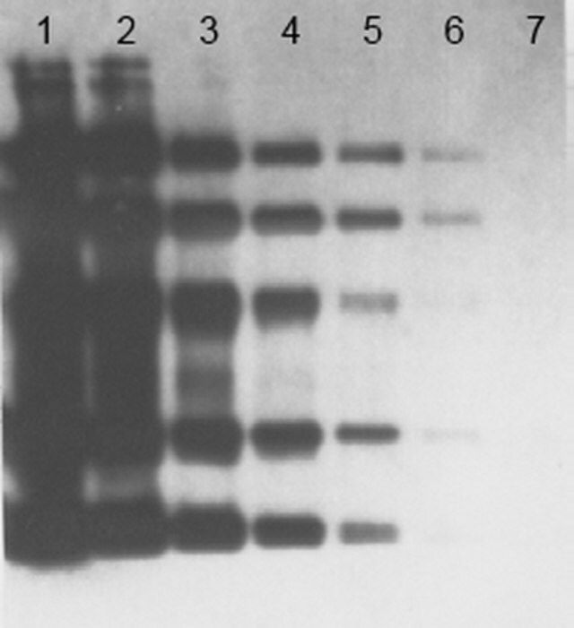 OxyBlot Protein Oxidation Detection Kit