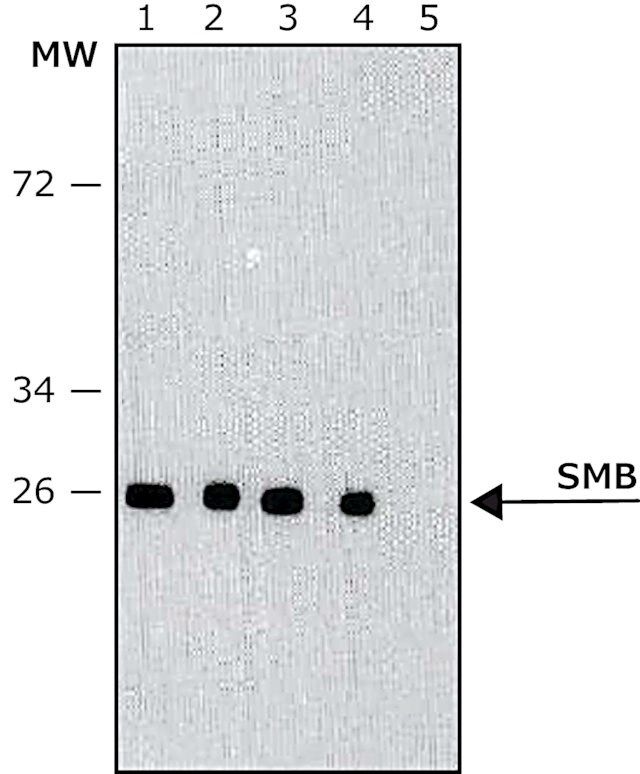 Monoclonal Anti-SmB antibody produced in mouse