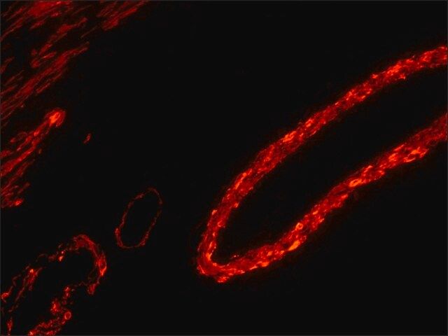 Streptavidin-R-Phycoerythrin from <i>Streptomyces avidinii</i>