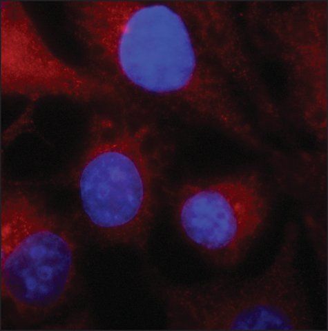 Anti-SDCBP antibody produced in rabbit