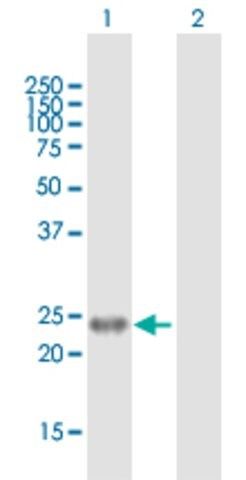 Anti-EDN1 antibody produced in mouse