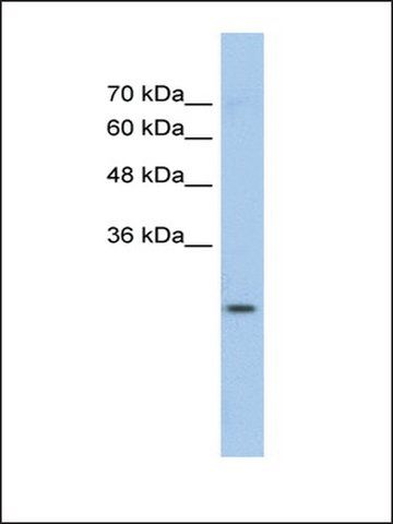 Anti-GSTM1 antibody produced in rabbit