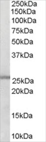 Anti-GSTM1/GSTM2 antibody produced in goat