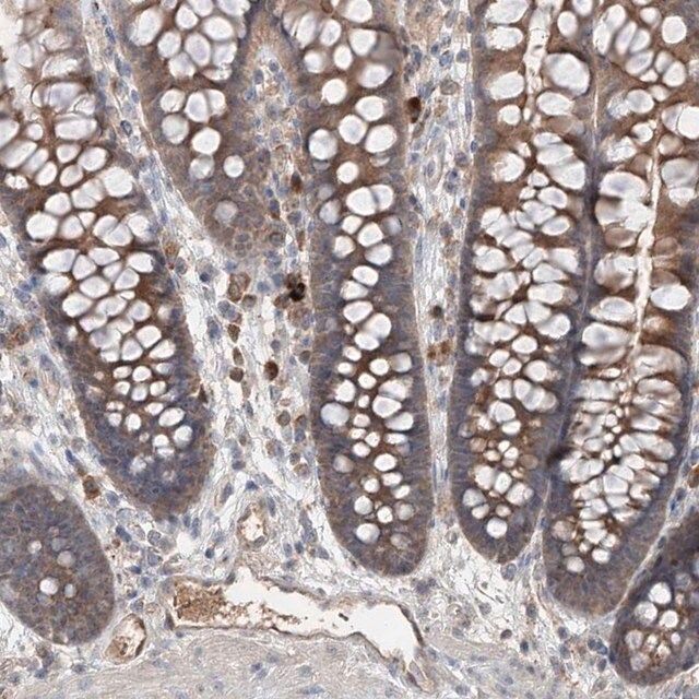 Anti-EDN1 antibody produced in rabbit