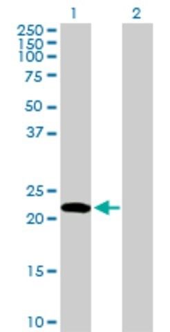 Anti-EDN1 antibody produced in rabbit