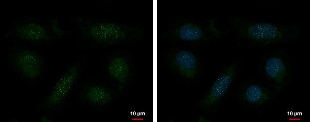 Monoclonal Anti-TERF1 antibody produced in mouse