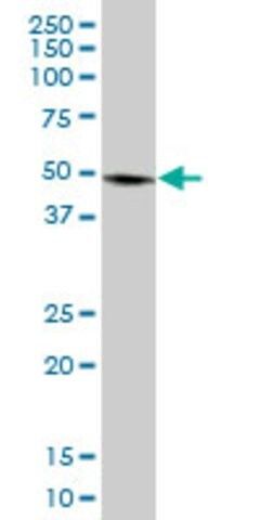 Anti-PLIN3 antibody produced in mouse