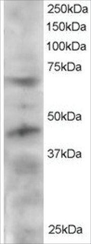 Anti-TERF1/PIN2 antibody produced in goat