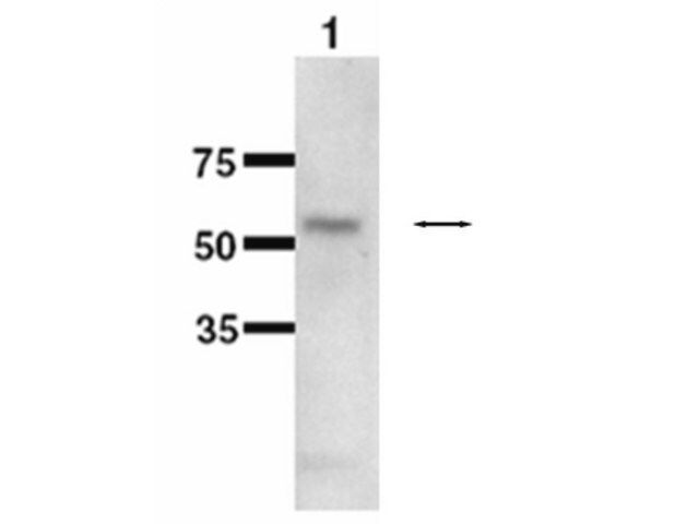 Anti-Cytochrome P450 1B1 Antibody