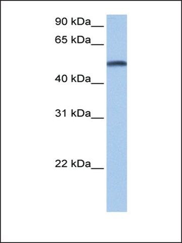 Anti-CYP1B1