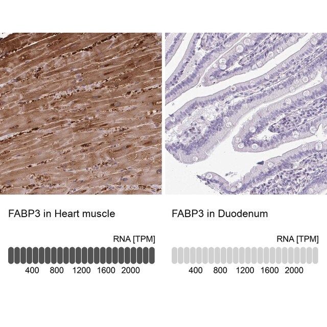 Anti-FABP3 antibody produced in rabbit