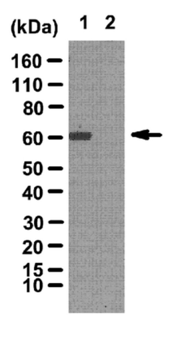 Anti-phospho CARM1 (Ser228) Antibody