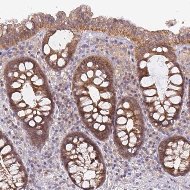 Anti-GSTM1 antibody produced in rabbit