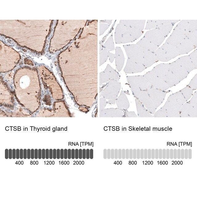 Anti-CTSB antibody produced in rabbit