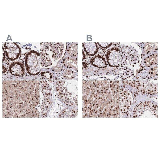 Anti-HDGF antibody produced in rabbit