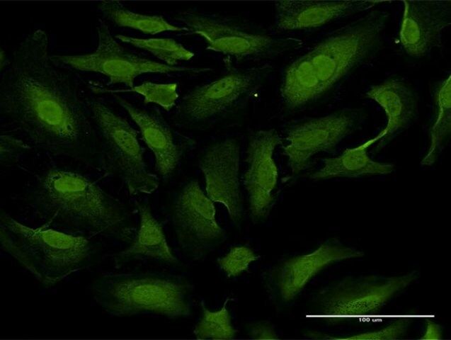 Monoclonal Anti-TKTL1 antibody produced in mouse