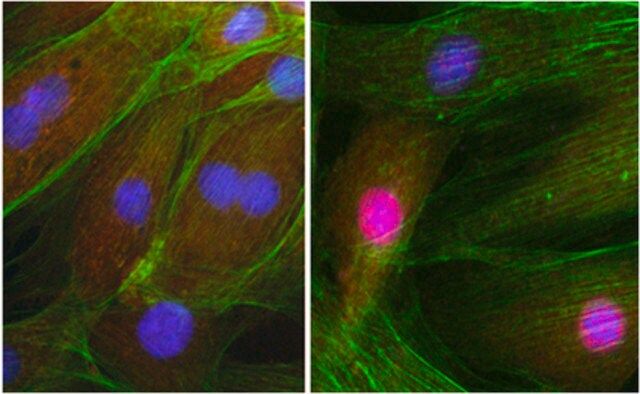 Anti-NRF-1 Antibody