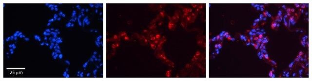 Anti-SFTPB antibody produced in rabbit