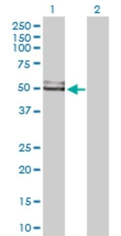 Anti-GDI1 antibody produced in rabbit