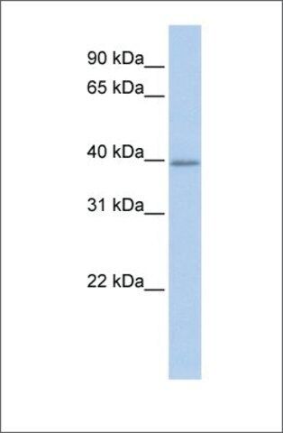 Anti-TXNIP antibody produced in rabbit