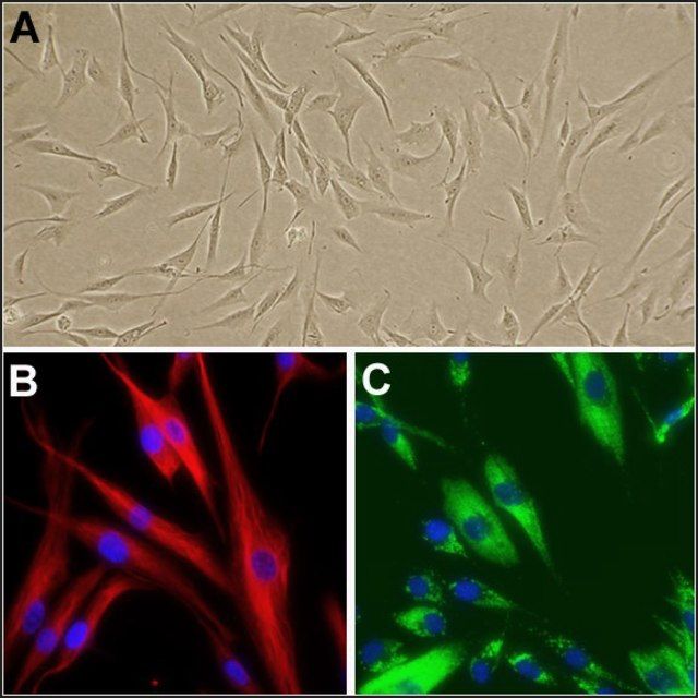 Human Dermal Fibroblasts: HDF, fetal