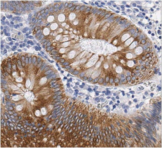 Anti-Cytokeratin 18 Antibody, clone CK2 (Ascites Free)