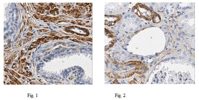 Anti-Filamin A Antibody, clone TI10, Ascites Free