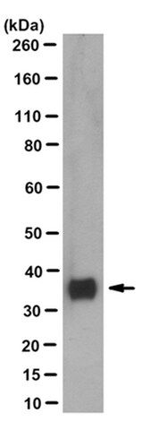 Anti-Synaptophysin Antibody, clone SP15 (Ascites Free)