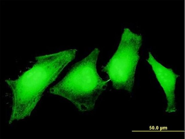 Monoclonal Anti-ASPA antibody produced in mouse