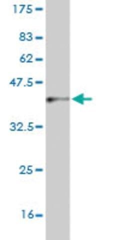 Monoclonal Anti-CNDP2 antibody produced in mouse