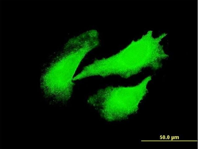 Monoclonal Anti-DYX1C1 antibody produced in mouse