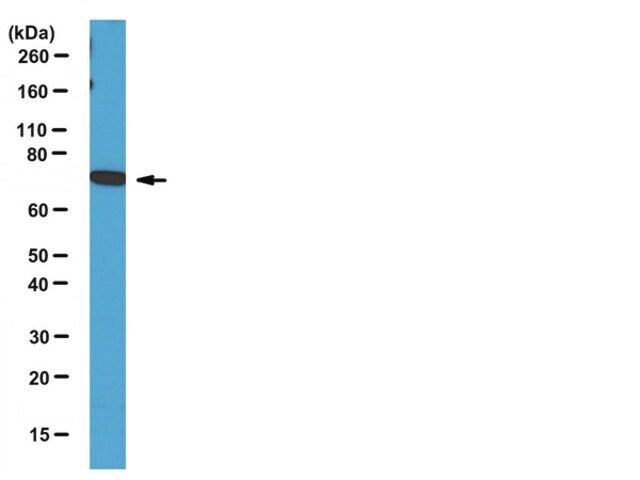 Anti-DDX3X Antibody