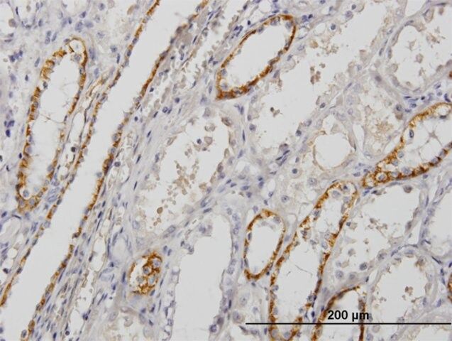 Monoclonal Anti-PALM antibody produced in mouse