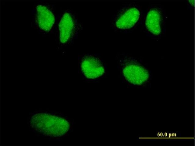 Monoclonal Anti-WRN antibody produced in mouse