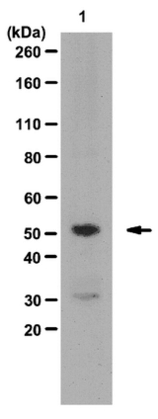 Anti-KLF5 (Krppel-like factor 5) Antibody