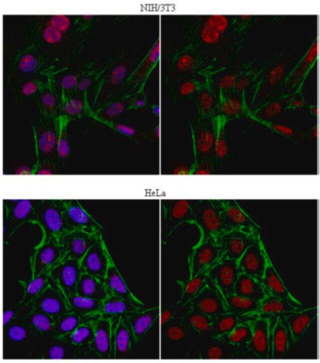 Anti-JHDM1B Antibody