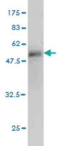 Monoclonal Anti-WISP2 antibody produced in mouse