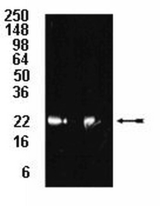 Anti-20S proteasome subunit 5 Antibody