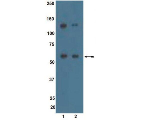 Anti-ALK7 Antibody