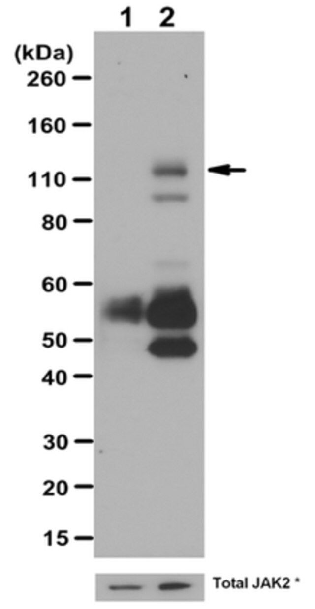 Anti-phospho-JAK2 (Tyr1007/1008) Antibody