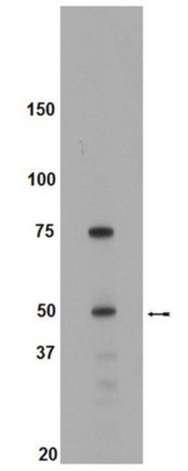 Anti-Brk Antibody