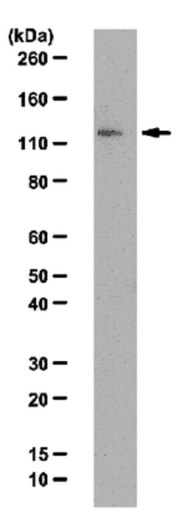 Anti-JMJD1A Antibody