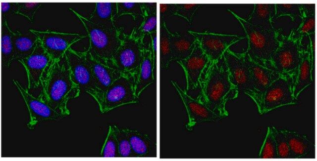 Anti-JMJD1C Antibody