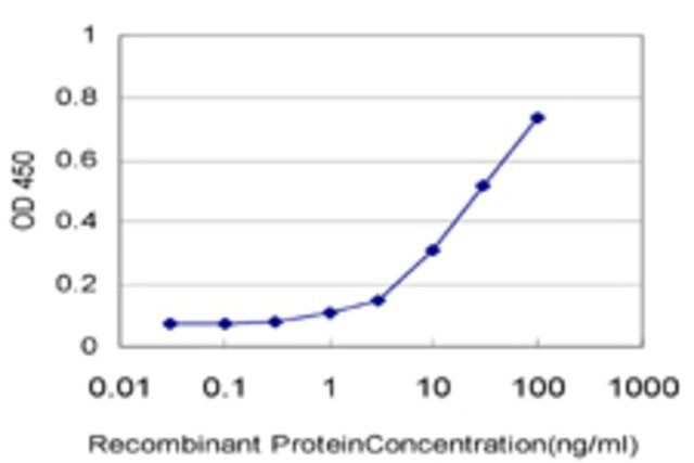 Monoclonal Anti-TTC3 antibody produced in mouse