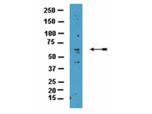 Anti-CARM1 Antibody