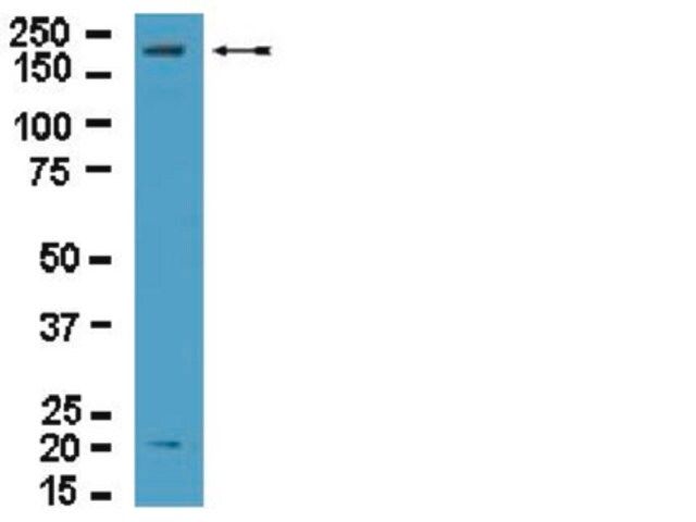 Anti-Dock2 Antibody