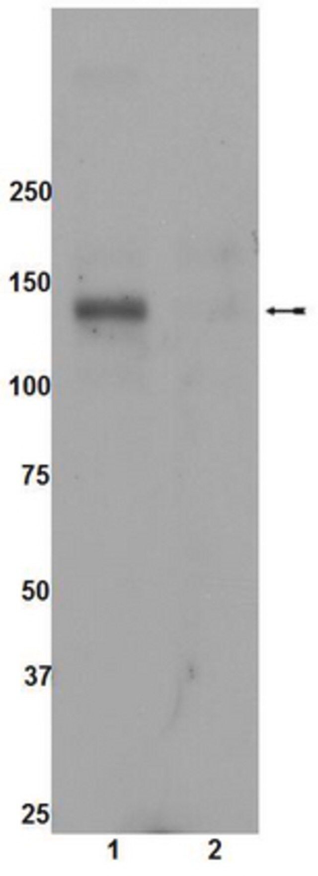 Anti-phospho-ACK1 (Tyr284) Antibody