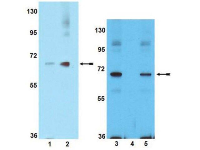 Anti-phospho-PAK1 (Ser199/Ser204) Antibody