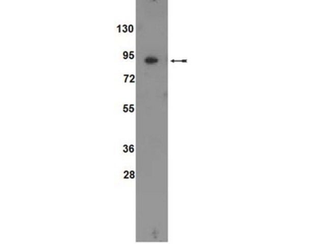 Anti-ATF6 Antibody